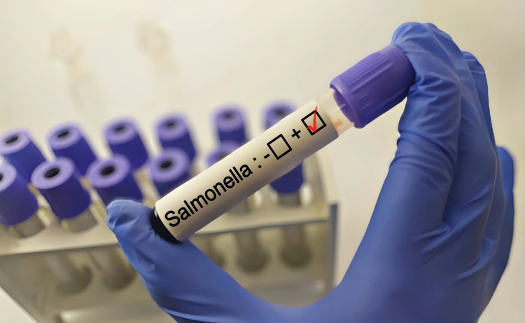 Diagnostician holding in hand a positive Salmonella bacteria test. Diagnostician holding in hand a positive Salmonella bacteria test.