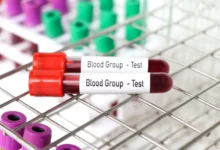 Blood sample in test tube.