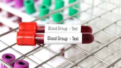 Blood sample in test tube.