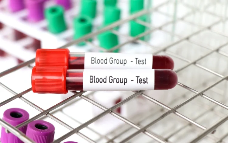 Blood sample in test tube.