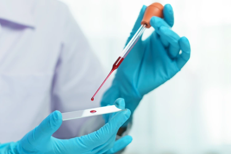 Blood group test in hospital laboratory Blood group test in hospital laboratory.