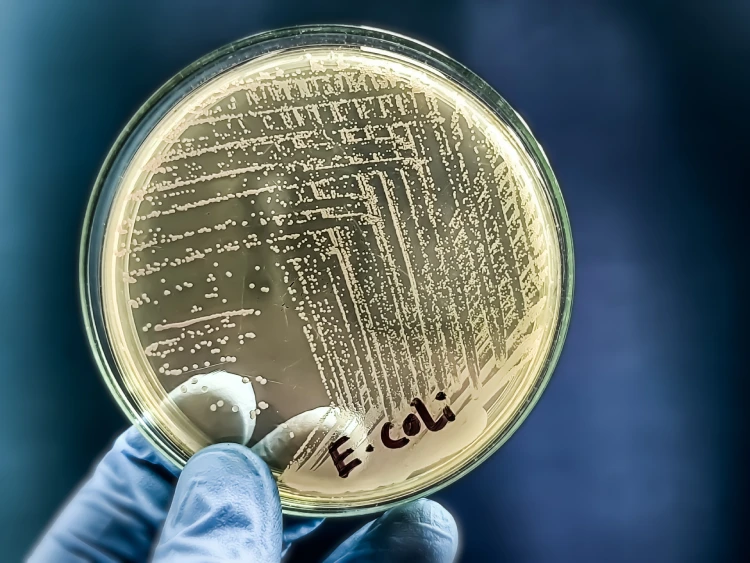 Colonies of the pathogenic bacterium E. coli. Colonies of the pathogenic bacterium E. coli.